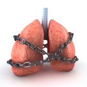 Pneumonia related image